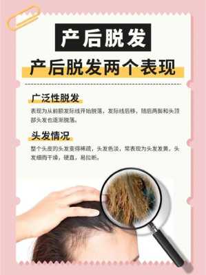 如何防止孕期脱发(如何防止孕期脱发的方法) 第2张 如何防止孕期脱发(如何防止孕期脱发的方法) 第2张