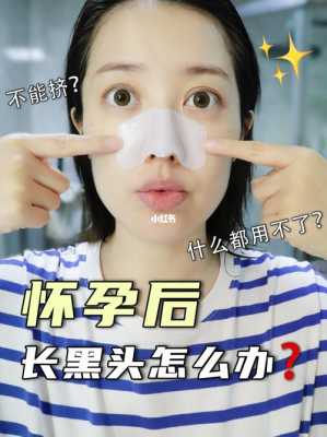 孕期如何去黑头(孕期如何去黑头) 第1张 孕期如何去黑头(孕期如何去黑头) 第1张