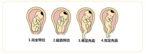 每天蹲着胎儿会畸形吗(每天蹲着胎儿会畸形吗图片) 第2张 每天蹲着胎儿会畸形吗(每天蹲着胎儿会畸形吗图片) 第2张