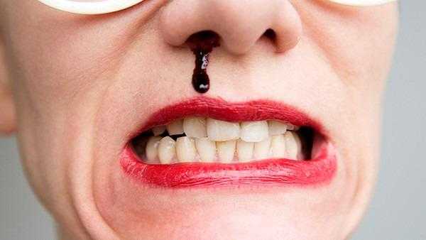 孕妇经常流鼻血是怎么回事,孕期总是流鼻血是什么原因 第2张 孕妇经常流鼻血是怎么回事,孕期总是流鼻血是什么原因 第2张