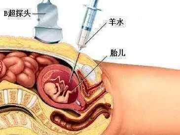 猪心肺能催小狗奶吗,促进胎儿心肺成熟的针有副作用吗 第2张 猪心肺能催小狗奶吗,促进胎儿心肺成熟的针有副作用吗 第2张