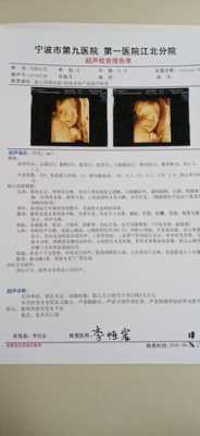 怀孕23周胎儿彩超(孕23周,四维彩超有个NF值是什么) 第1张 怀孕23周胎儿彩超(孕23周,四维彩超有个NF值是什么) 第1张