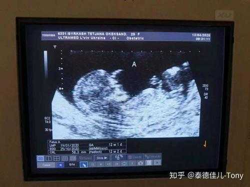 五维拍照对宝宝有影响吗,胎儿腹围小的危害有哪些 第1张 五维拍照对宝宝有影响吗,胎儿腹围小的危害有哪些 第1张