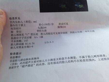 27周胎儿头围标准(2021年11月27号对应的新历是) 第3张 27周胎儿头围标准(2021年11月27号对应的新历是) 第3张