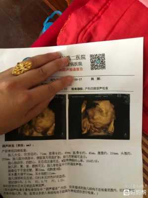 27周胎儿头围标准(2021年11月27号对应的新历是) 第2张 27周胎儿头围标准(2021年11月27号对应的新历是) 第2张