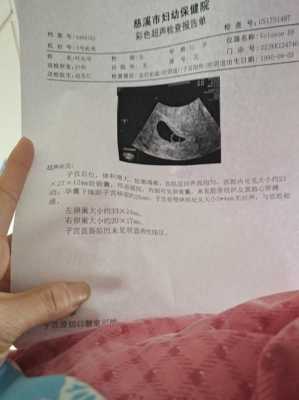 怀孕有9周了,产检结果见微弱原始心管搏动,这是什么意思,怀孕第九周胎儿发育图 第2张 怀孕有9周了,产检结果见微弱原始心管搏动,这是什么意思,怀孕第九周胎儿发育图 第2张