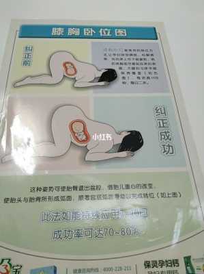 臂位胎儿怎样睡好（臂位胎儿怎样睡好）  第2张