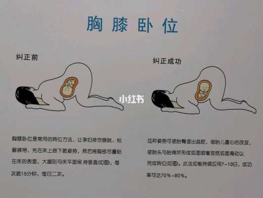 臂位胎儿怎样睡好（臂位胎儿怎样睡好）  第1张