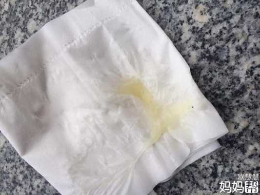 孕期白带好多 第2张 孕期白带好多 第2张