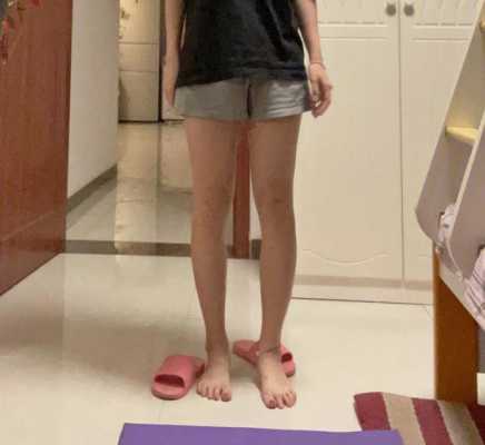 孕期上身变胖（上身胖、腿特别细，这样的体型正常吗）  第2张