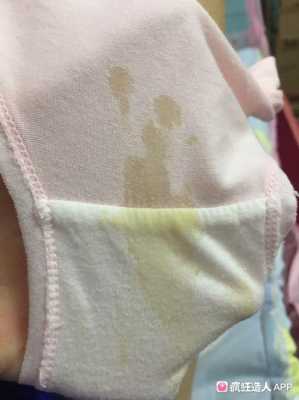 孕期流黄水(孕期流黄水) 第1张 孕期流黄水(孕期流黄水) 第1张