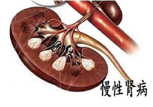 孕期慢性肾炎(孕期慢性肾炎会不会影响宝宝发育?) 第3张 孕期慢性肾炎(孕期慢性肾炎会不会影响宝宝发育?) 第3张