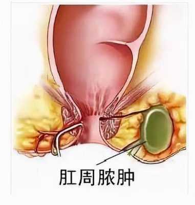 孕期肛门长肉疙瘩(孕期肛门长肉疙瘩会自己恢复吗) 第2张 孕期肛门长肉疙瘩(孕期肛门长肉疙瘩会自己恢复吗) 第2张