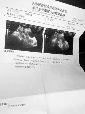孕期检查报告（孕期检查报告医院要收回留档吗）  第2张