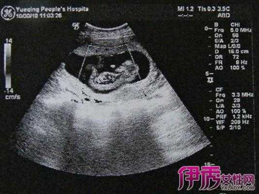 胎儿都在右腰上动男女(胎儿都在右腰上动男女) 第2张 胎儿都在右腰上动男女(胎儿都在右腰上动男女) 第2张
