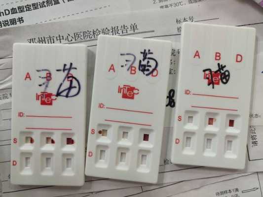 孕期rh血型阳性(血型鉴定阳性是什么) 第3张 孕期rh血型阳性(血型鉴定阳性是什么) 第3张