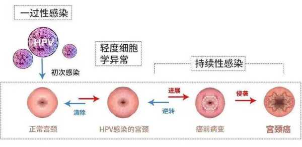 孕11周,水样黄色分泌物,怎么办,孕期水样黄色分泌物 第1张 孕11周,水样黄色分泌物,怎么办,孕期水样黄色分泌物 第1张
