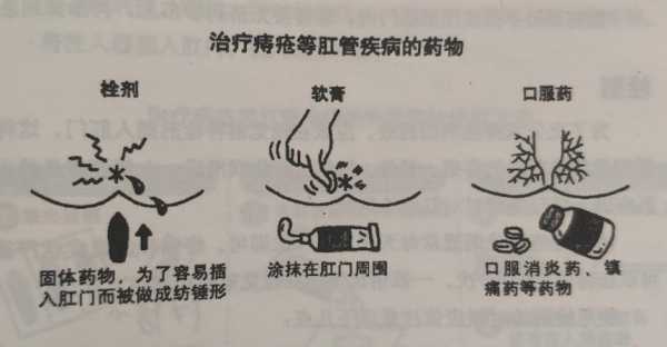 孕期痔疮怎么缓解（孕妇得了痔疮，便后一直流血，该怎么止血呢）  第2张