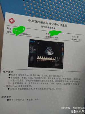 医生说胎儿腿长是暗示(医生说胎儿腿长是暗示男女吗) 第1张 医生说胎儿腿长是暗示(医生说胎儿腿长是暗示男女吗) 第1张