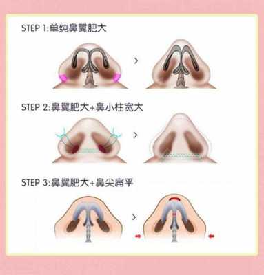 胎儿鼻前皮肤增厚(胎儿鼻前皮肤增厚畸形几率) 第3张 胎儿鼻前皮肤增厚(胎儿鼻前皮肤增厚畸形几率) 第3张