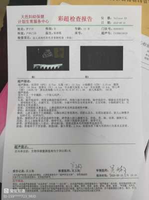 159的大唐标准属性,胎儿心率159是女孩吗还是男孩 第3张 159的大唐标准属性,胎儿心率159是女孩吗还是男孩 第3张