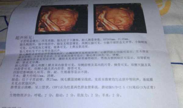 胎儿脊椎成串珠状男孩(胎儿脊柱呈串珠状排列是男孩女孩) 第2张 胎儿脊椎成串珠状男孩(胎儿脊柱呈串珠状排列是男孩女孩) 第2张