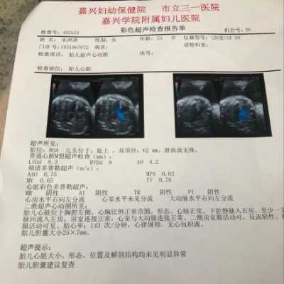 胎儿胆囊偏大能生吗(胎儿胆囊未见正常吗) 第2张 胎儿胆囊偏大能生吗(胎儿胆囊未见正常吗) 第2张