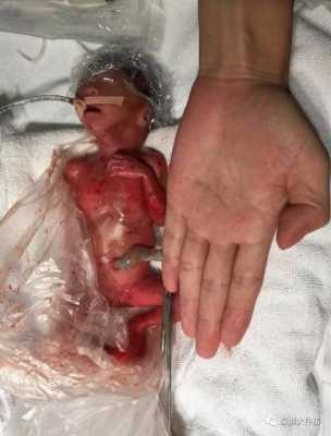 孕二十三周胎儿多大,23周胎儿体重标准值是多少 第3张 孕二十三周胎儿多大,23周胎儿体重标准值是多少 第3张