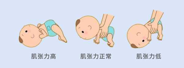 胎儿的脑瘫是怎样形成的,胎儿脑瘫是怎么形成的原因 第1张 胎儿的脑瘫是怎样形成的,胎儿脑瘫是怎么形成的原因 第1张