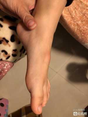 婴儿脚背骨头凸起是怎么了,胎儿骨骼发育不良原因有哪些 第2张 婴儿脚背骨头凸起是怎么了,胎儿骨骼发育不良原因有哪些 第2张