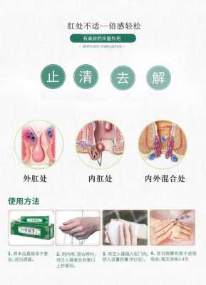 孕期外痔如何消肿(外痔可能是血栓痔,如何尽快消肿止痛) 第1张 孕期外痔如何消肿(外痔可能是血栓痔,如何尽快消肿止痛) 第1张