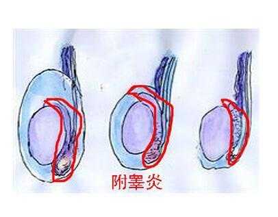 胎儿几个月睾丸下降（胎儿几个月睾丸下降至阴囊）  第2张