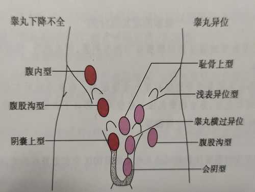 胎儿几个月睾丸下降（胎儿几个月睾丸下降至阴囊）  第3张