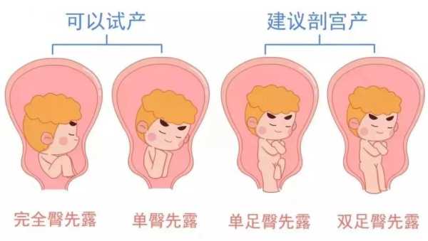 胎位不正是胎儿畸形吗(胎位不正是胎儿畸形吗) 第2张 胎位不正是胎儿畸形吗(胎位不正是胎儿畸形吗) 第2张