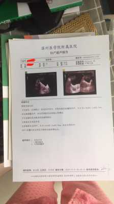 胎儿心管搏动是什么(怀孕50天,胎儿心跳搏动113次/分,正常吗) 第1张 胎儿心管搏动是什么(怀孕50天,胎儿心跳搏动113次/分,正常吗) 第1张