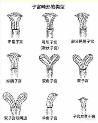 弓形子宫对胎儿的危害（弓形子宫对胎儿的危害）  第2张
