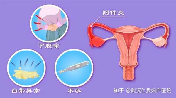 附件炎可以怀孕吗,孕期附件炎疼痛怎么办 第1张 附件炎可以怀孕吗,孕期附件炎疼痛怎么办 第1张