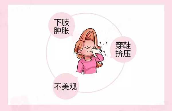 孕妇水肿会影响胎儿吗(胎儿全身皮下水肿能要吗) 第2张 孕妇水肿会影响胎儿吗(胎儿全身皮下水肿能要吗) 第2张