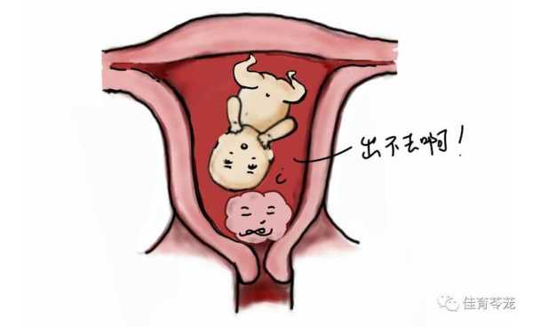 孕期暖巢囊肿(孕期暖巢囊肿会影响胎儿吗) 第2张 孕期暖巢囊肿(孕期暖巢囊肿会影响胎儿吗) 第2张