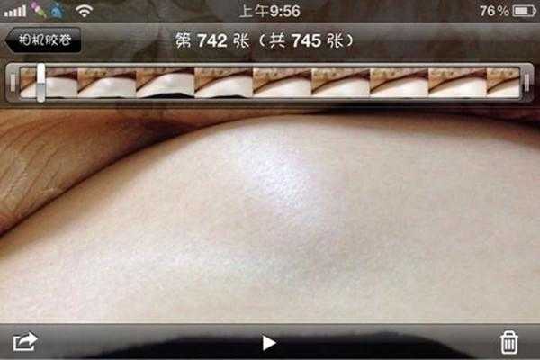 为什么胎儿喜欢鼓包,这是怎么回事呢,胎儿头鼓包大还是屁股大 第2张 为什么胎儿喜欢鼓包,这是怎么回事呢,胎儿头鼓包大还是屁股大 第2张