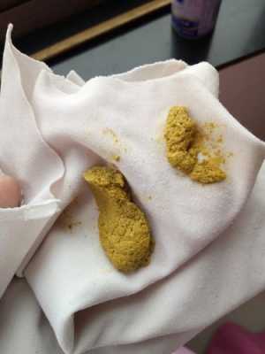 怀孕后大便就很多了是怎么回事,孕期屎特别多老放屁正常吗 第1张 怀孕后大便就很多了是怎么回事,孕期屎特别多老放屁正常吗 第1张