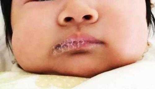 宝宝张嘴呼吸正常吗,胎儿在腹中张口正常吗会胎停吗  第2张