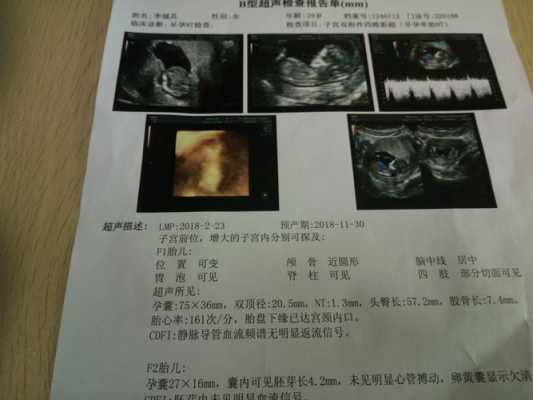4个月胎儿胃泡多大,胎儿胃泡不显示严重吗怎么办 第2张 4个月胎儿胃泡多大,胎儿胃泡不显示严重吗怎么办 第2张