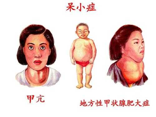 胎儿呆小症能查出来吗(胎儿呆小症能在孕检中检查出来吗?) 第2张 胎儿呆小症能查出来吗(胎儿呆小症能在孕检中检查出来吗?) 第2张