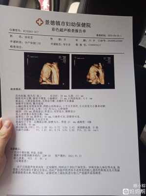 胎儿肾积水严重怎么办(四维彩超查出宝宝肾有积水怎么办) 第2张 胎儿肾积水严重怎么办(四维彩超查出宝宝肾有积水怎么办) 第2张
