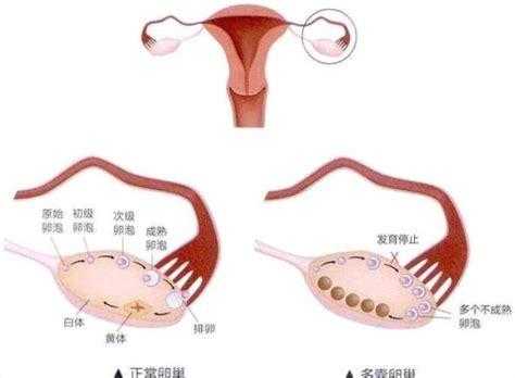 子宫小对胎儿有影响吗(子宫小对胎儿有影响吗) 第2张 子宫小对胎儿有影响吗(子宫小对胎儿有影响吗) 第2张