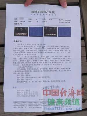 我怀孕30周了做B超检查左心室有强光点回声,胎儿心脏b超多少钱一次 第2张 我怀孕30周了做B超检查左心室有强光点回声,胎儿心脏b超多少钱一次 第2张