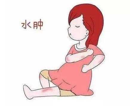 怎么消除孕期水肿（怎么消除孕期水肿最有效）  第3张