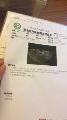 孕期查出子宫肌瘤(孕期查出子宫肌瘤要紧吗) 第1张 孕期查出子宫肌瘤(孕期查出子宫肌瘤要紧吗) 第1张