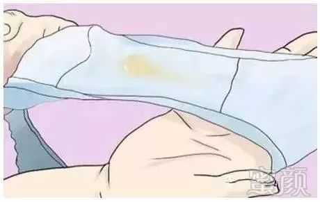 孕期阴部酸胀(孕期阴部酸胀) 第2张 孕期阴部酸胀(孕期阴部酸胀) 第2张